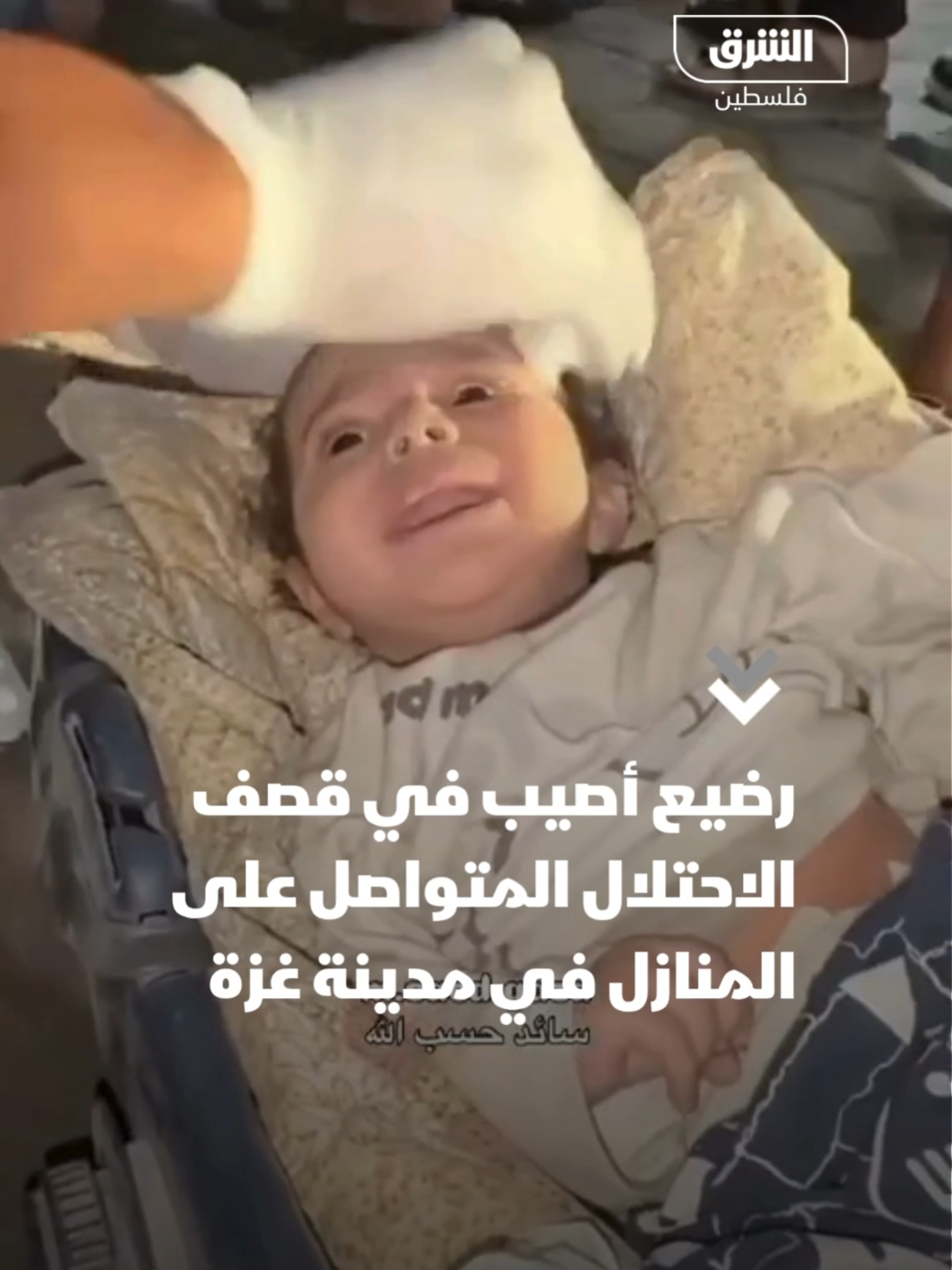 رضيع أصيب في قصف طائرات الاحتلال المتواصل على المنازل في مدينة غزة #الشرق #الشرق_فلسطين