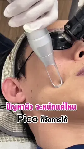 ปัญหาผิว จะหนักแค่ไหน Pico จัดการได้ #timelessclinic #picolaser #ดันขึ้นหน้าฟีดที #fyp #เทรนด์วันนี้ 