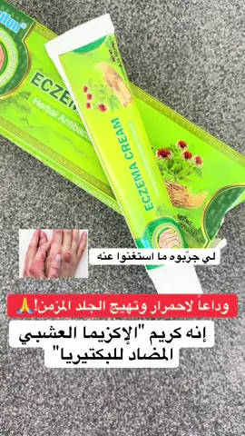 #اكزيما #علاج_الإكزيما #الاكزيما_البهاق_الصدفيه_التصبغات #السعودية🇸🇦 #اكسبلور 
