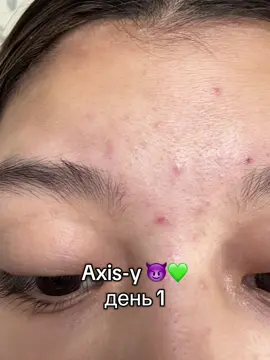 @AXIS-Y СНГ | CIS Official 💚#рекомендации #axisy #axisydarkspotserum #axisycis #BeautyTok 