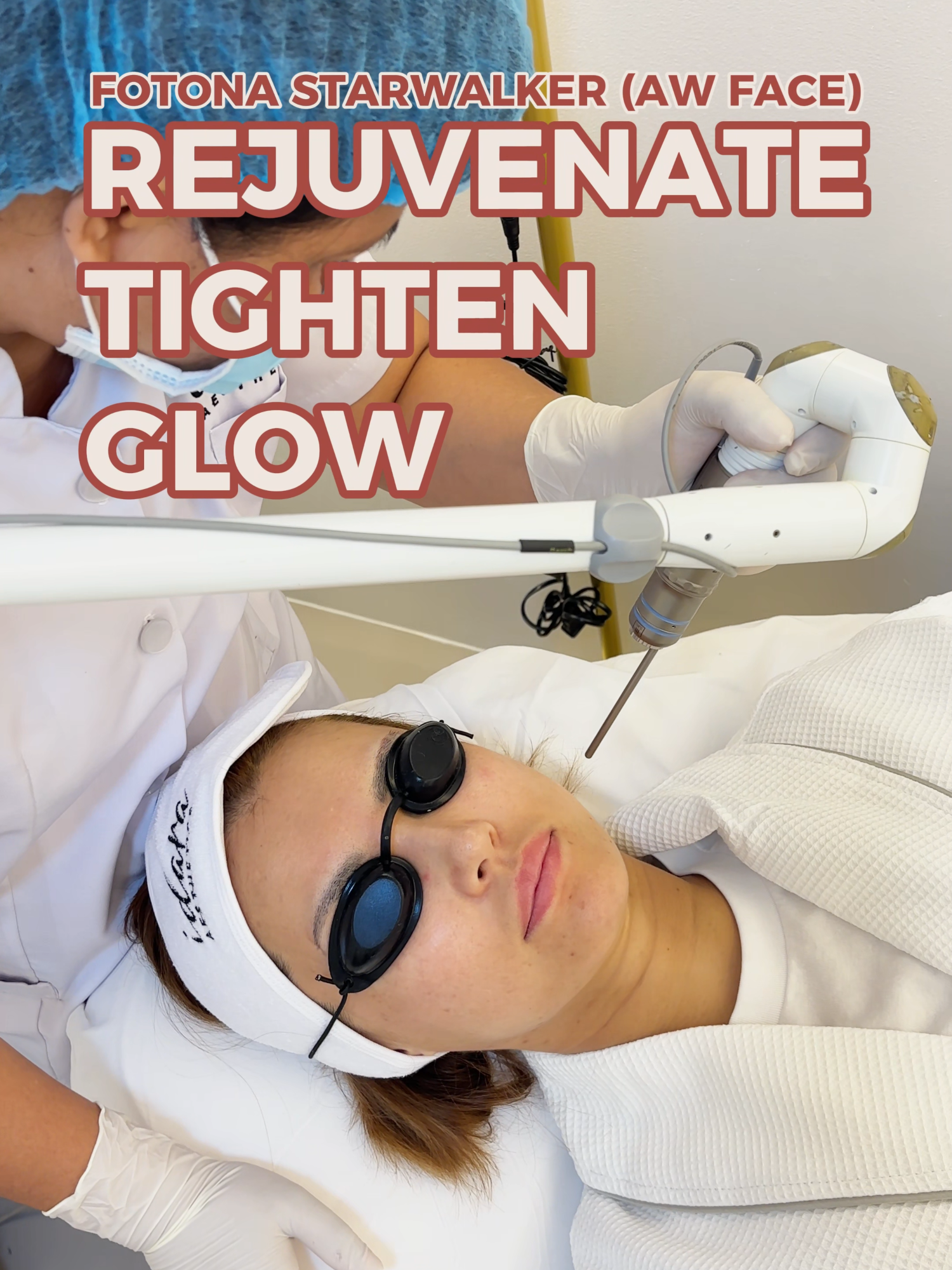 Book Your Fotona Starwalker Now! ✨@maria.ozawa0108  #idaraaesthetics #experiencetherealcare #fyppppppppppppppppppppppp