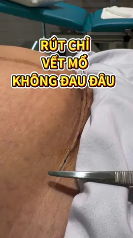 Rút chỉ vết mổ không đau đâu #bsleduytoantruongkhoad4 #khamthaitotnhat #phongkhamxinnhat #khoamodichvud4 #modedichvu 