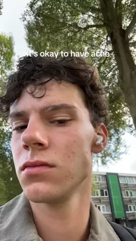I know that there are so many people with worse acne and many with less. But please rember that we’re all humans and most of the time it’s something we can’t control. #acne 