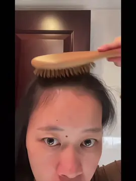 Thanh vừa nhận được lời phản hồi tích cực từ một khách hàng sau khi hoàn tất liệu trình phục hồi tóc tại phòng khám. Sau quá trình kích thích nang tóc và nuôi dưỡng chuyên sâu, tóc con đã mọc trở lại rõ rệt, chắc khỏe và dày đều hơn trước. Chúc mừng em nhé! #bacsidalieutranvinhthanh #rungtoc #rungtocsausinh #hoidau #xuhuong 