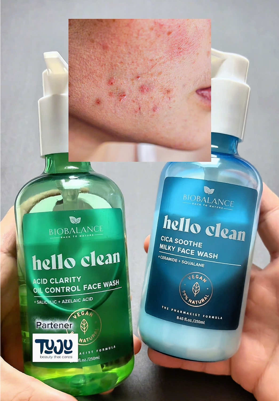 #geldecuratare #tengras #tenuscat #curatareapielii #skincarepebune 