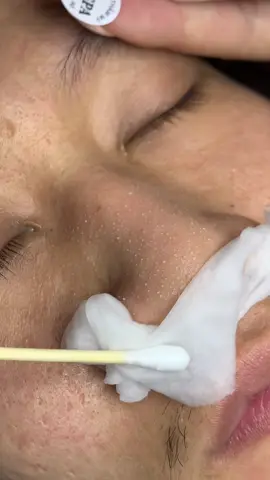 Trắng cỡ này#chamsocdaseo#chamsocda#chamsocdamun#chamsocdanam#tanbinh      