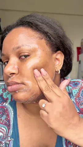 Instant Acne Fix! #APRILSKIN #APRILSKINskincare #allurebestofbeauty #acnetreatment #exfoliation  @APRILSKIN USA 
