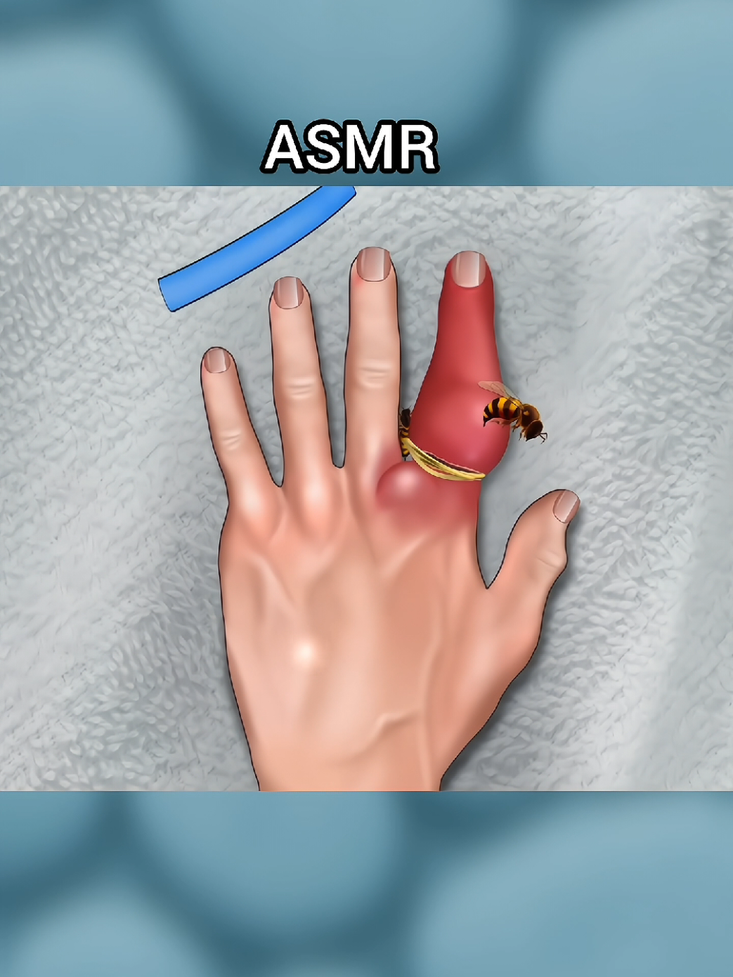 ASMR Treatment #asmr #ukdoctor #SatisfyingVideo #viraltiktok #relaxingvideos 