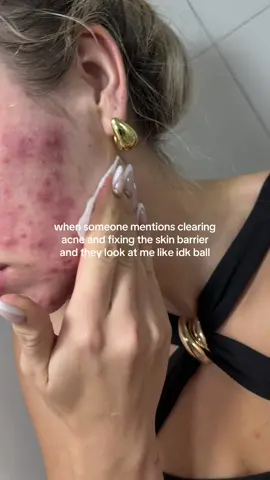 clearing acne and strengthen the skin barrier is hard, but possible… #skin #skincare #skintok #dralthea 