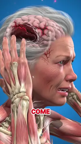 Do you or your loved ones have any signs of a stroke? #stroke #strokesurvivor #strokerecovery #healthtip #usa 