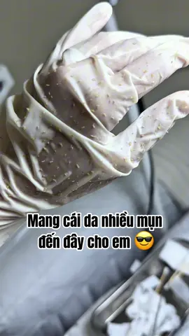 Lấy mụn chuẩn y khoa mà chỉ có 150.ka, quá là hời 😚😚 #nanmundanang #peeldadanang #caytrangdanang #SpaChamsocdadanang #spauytindanang 