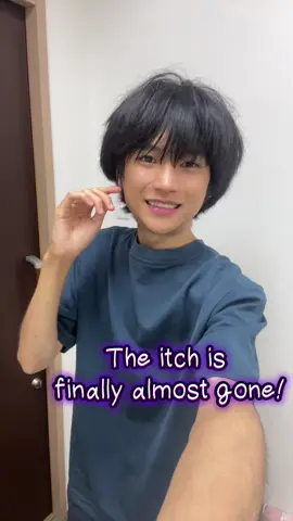 Finally Free from Scabies! My 4-Month Battle Is Over🥺　From Itchy Zombie to Human Again