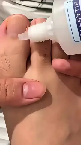 REMOVEDOR DE CUTÍCULAS  #achadinhosdashopee #achadinhosshopee #achadinhos 