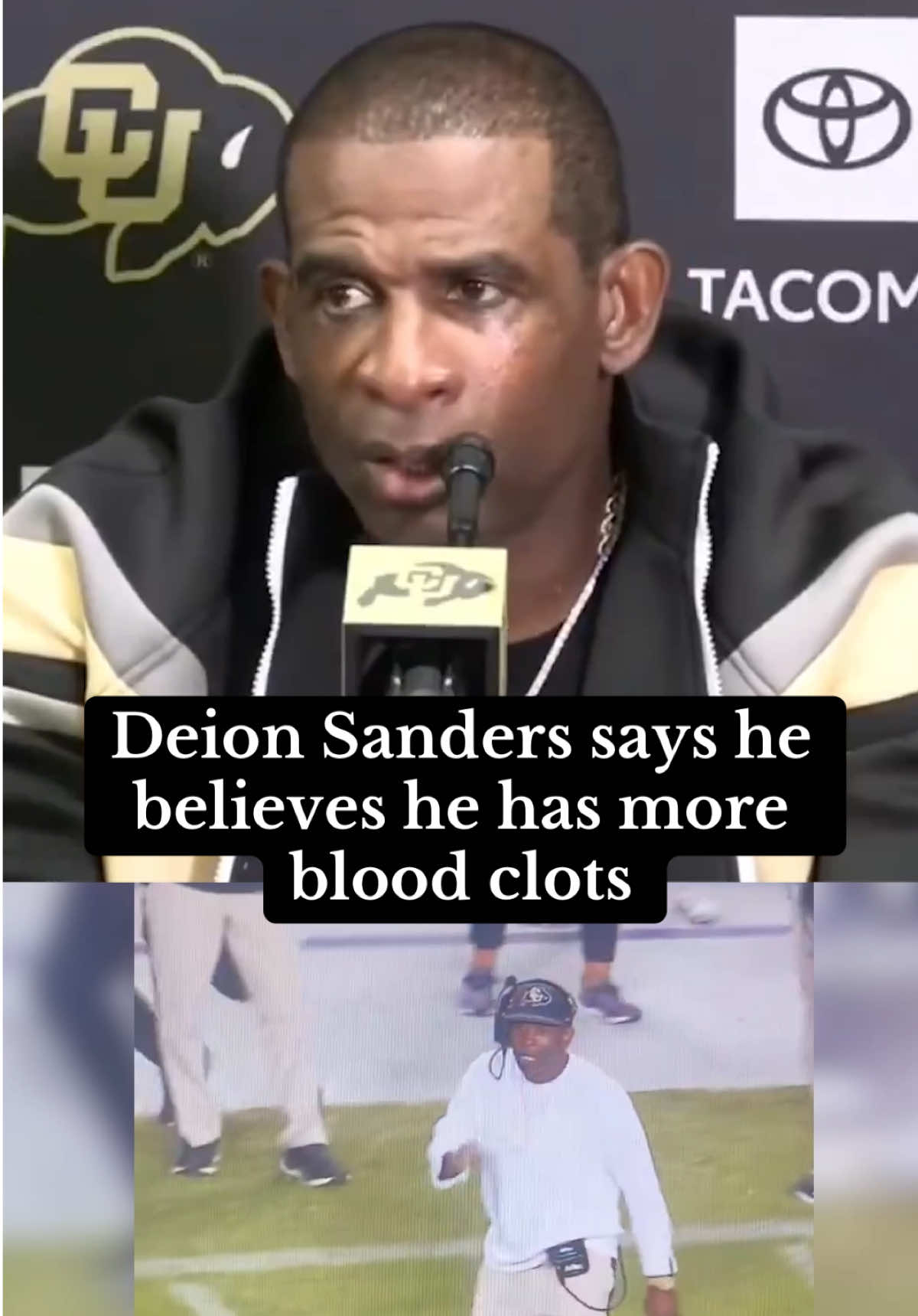 Deion was seen limping around without one shoe on during Saturday’s game vs TCU #deionsanders #deion #coloradofootball 