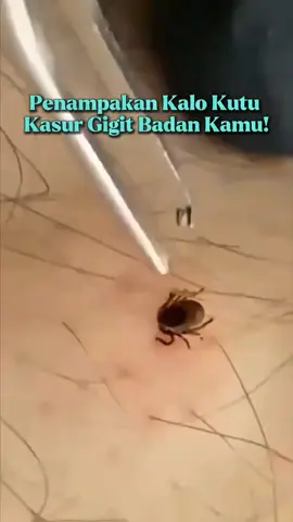 yakin kalian mau badan digigit kutu kasur?! 😖😧 #wiselieindonesia #gajiansale #pengusirtungau #pembasmitungaukasur #sprayantitungaudankutukasur 