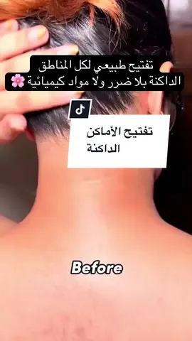 جربت هاد الوصفة مرة وحدة وشوفي النتيجة بعينيك 😳🔥 الجسم ولى ناعم ومفتح بطريقة خرافية#explore #fouryou #وصفات_طبيعية #جمالك_طبيعي #تفتيح 