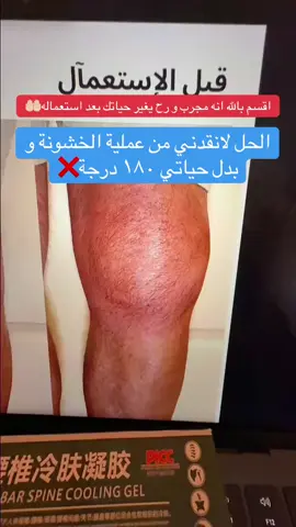 #الارجل #الرقبة #خشونة_الركبة #المفاصل #الابهر 