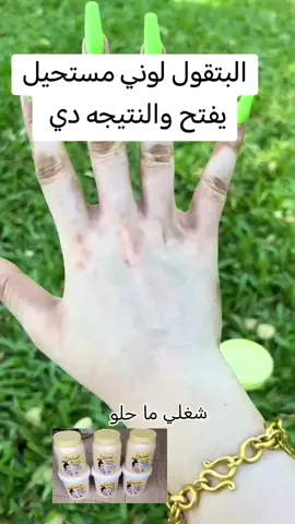 #خلطات_تبييض #خلطات_تفتيح #خلطات_تفتيح_نضارة #خلطات_تفتيح_في_اسبوع #يوجد_لدينا_خدمة_توصيل_لكل_الولايات_الآمنة 