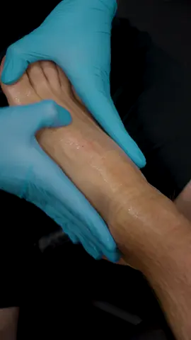 Top of Foot Pain? Here’s What Could Be Going On... That tight, pulling ache across the top of your foot isn’t random. Running right through this area are your extensor tendons, the ones that lift your toes and foot when you walk, run, or squat. When they get irritated, stiff, or overloaded, you might notice: • Pain across the top of the foot • Tightness into the shin (shin splints feeling) • Difficulty lifting the foot properly • Pinching or discomfort when lacing up shoes Hands-on treatment here can give instant relief, easing tension, improving blood flow, and helping the ankle move better. But the bigger picture? If your ankle mobility, calf tightness, or walking mechanics aren’t addressed, that pain will keep coming back. That’s why we look at the whole chain, not just where it hurts. The Sharp Physio Team #footpain #anklepain #shinSplints #physio