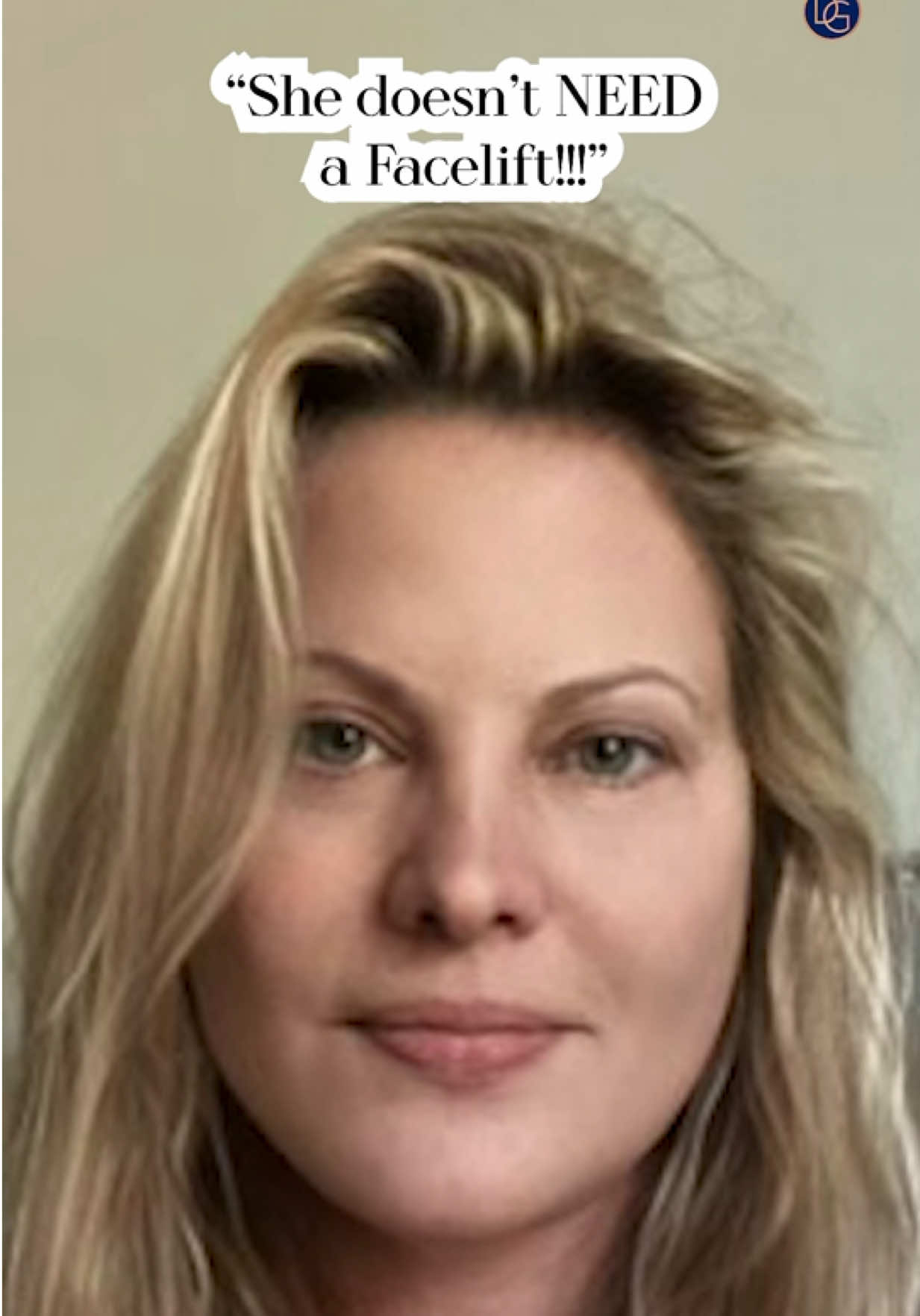 When I first shared this result over two years ago, people said it couldn’t be real. 