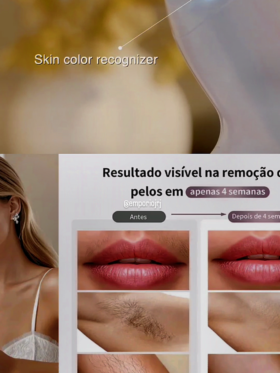 Depilador de pêlos a laser MLAY T4 IPL portátil para todo o corpo #depilação #laser #cortar #foryour #creatorsearchinsights 