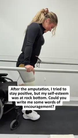 #singlewoman#lonelywoman#fyp#amputation#singlelife#singleandreadytomingle 