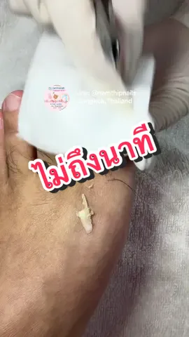 #namthipnails #ตัดเล็บขบ #ตัดหนัง #ทำเล็บ#ทําเล็บดเล็บขบ #ร้านตัดเล็บขบราม2ails  Line : @namthipnails  นัมเบอร์วัน8 ตลาดม.ราม2  กทม ร้านเปิดทุกวัน เวลา12.00น-22.00น.  