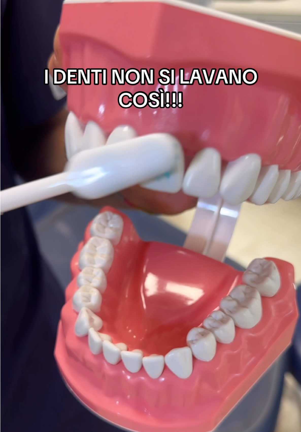I denti NON SI LAVANO COSÌ  C’è una tecnica precisa e oggi la vediamo insieme! Bisogna strofinare sulla gengiva simulando una vibrazione e poi spazzolare seguendo la direzione del dente!
