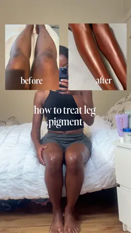 Let’s talk leg hyperpigmentation ✨ because smooth, even-toned skin is science + consistency. The @medicube global exfoliating pad gently buffs away dull, dead skin to help treatments penetrate deeper  This @Ameliorate Skin lotion is a powerhouse with lactic acid to resurface and soften rough, pigmented skin The @TOPICALS slather retinol body lotion speeds up cell turnover to fade dark spots and smooth texture over time and this is a perfect product for this. Seals it all in with an occlusive lotion like the @Vaseline body oil to prevent water loss and maximising glow. Remember to be consistent to see maximised results. 💫