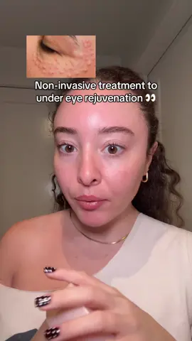 Needles under my eyes?? No thanks 🙂‍↔️ I’ll use these eye patches instead #abib #abibpdrn #pdrn #pinkroutine #eyepatches @Abib Cosmetics 