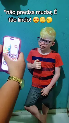 não precisa mudar, é tão lindo meu pequeno 😍💙🤍 #fy  #albino  #naoprecisamuda 