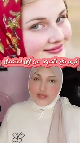 كريم نفخ الخدود من أول استعمال  #كريمات #وصفات #سماح_والى 