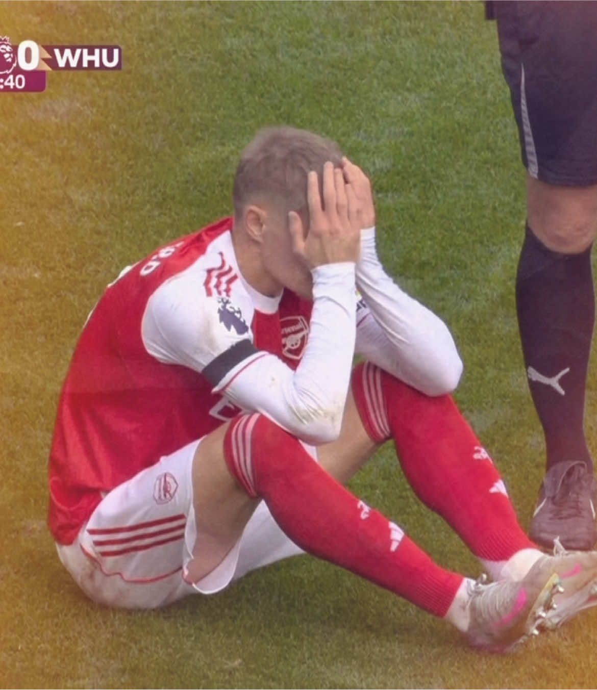 Slowly getting ruined by injuries😢 | #odegaard #arsenal #PremierLeague #footballedit #championsleague 