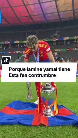 Porque lamine yamal tiene  Esta fea contrumbre  #lamineyamal #football 