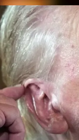 Cómo un atentado fallido convirtió a Trump en el elegido por Diós