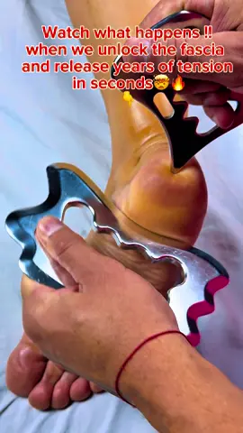 When pain hides in your feet — it shows up everywhere else. 👣💥 Watch what happens when we unlock the fascia and release years of tension in seconds… Most people don’t realize how tight their heel is until THIS happens!” ⚡ Viral Description: Your foot pain, back pain, even knee stiffness — all start right here. This tool breaks down stubborn fascia and stagnant energy that blocks your body’s natural flow. After this release, your entire leg feels lighter, your walk changes, and your posture improves instantly. This isn’t just scraping… it’s a reset for your nervous system. 💬 Comment “RELIEF” if you need this done to your feet next! 📍Location: Kinezio Advanced Massage | Lutz, FL 🔗 Book now: KinezioArt.com 🔥 Hashtags: #FasciaRelease #FootPainRelief #PlantarFasciitis #HeelPain #MyofascialRelease              