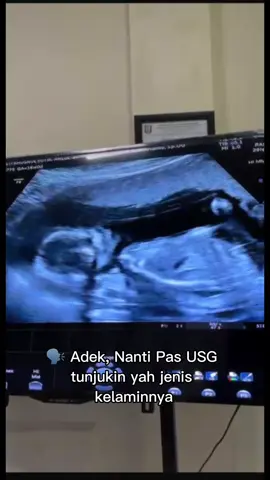 Hpl maret musim jk apa nih👶🏻🤭  #hplmaret #pregnant #babygir💗💗💗💖💖💖❣️ 