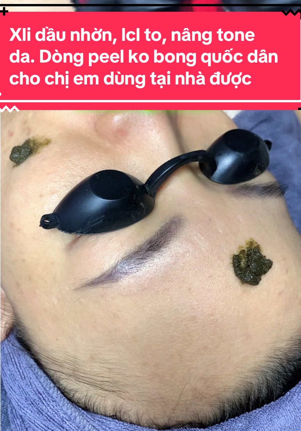 Xli dầu nhờn, lcl to, nâng tone da. Dòng peel ko bong quốc dân cho chị em dùng tại nhà được#daotaohocvienchuyennghiep #túdoli #mixpeel #trắngda #ủtrang 