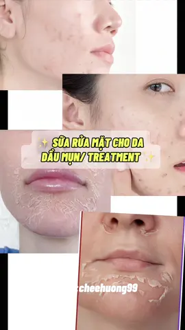 Sữa rửa mặt quốc dân rồi 😁#unboxing #simple #hoptaccungunilever #suaruamat #viral 