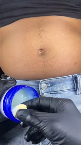 Many people are trying this belly button trick because they say it may support digestion, reduce bloating, and even help with weight control. 😱✨ A simple home secret that is shocking everyone. Would you try it? #fyp 