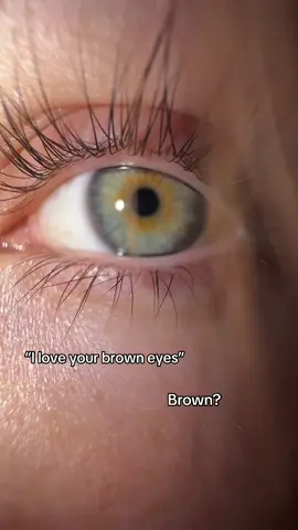 Nah central heterochromia 👀 #eyes #trend #centralheterochromia #fypシ゚viral 