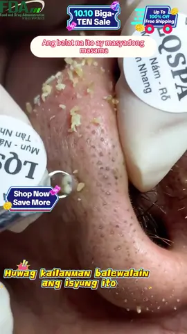 📣💚 Large amount of coupons! It is more cost-effective to buy two now~ 💥💗SHEEureka Gentle Exfoliation, safe ingredients, contains algae, insist on periodic use, can improve skin dullness, brighten skin, suitable for whole body.👉🏻🥳 #skincare #sheeureka #fyp #exfoliation PHRC3594