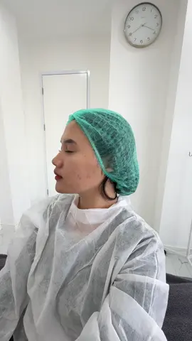 Pertama kali cobain treatmnt di sini #treatmntacne #laserpico #vinachuu12 