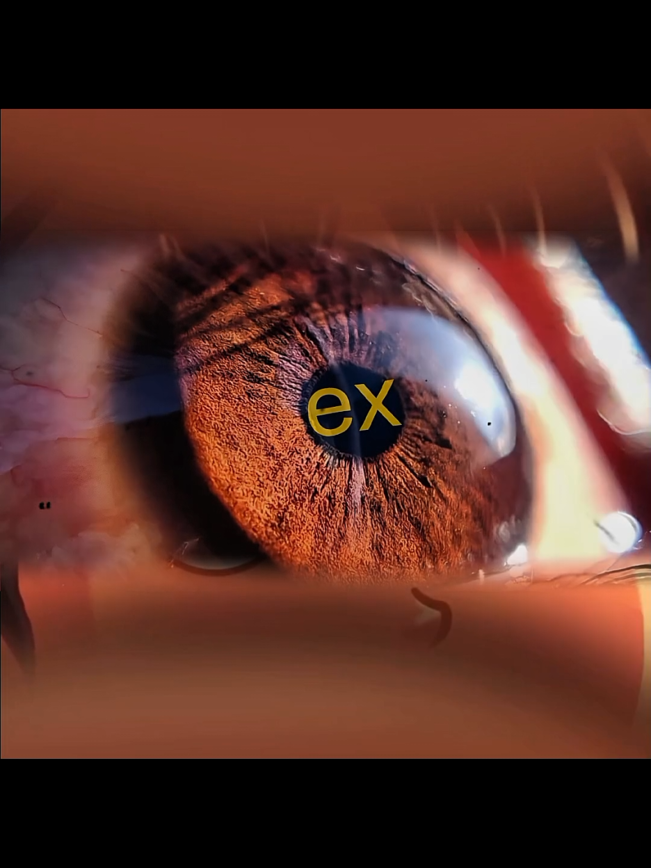 এই ex ওই ex নাহ.. 😫 #mistertime07 #tranding #investing #forextrading #exness 