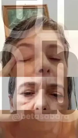 LINK EM MEU PERFIL! #rugasatenuadas #rugasprofundas #rugasfaciais #rugasemanchas #rugasfinas #rugasmr #rugasnatesta #rugasnatesta #pelehidratada #antirrugas #peleperfeita #rugas #colageno #retinol #skincarebrasil #linknomeuperfil #promoção #oferta #resultadoreal #antesedepois #comprovado #semrugas #beleza #rugasnatestanuncamais #rugasatenuadas #rugasprofundas #rugasfaciais
