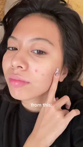 dr lan one of my fave skincareee #fyp #drlan #drlansalicylicacid #drlantoner #skincare 