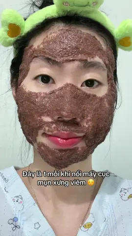 Giá rẻ, phù hợp với túi tiền của t nữa á 😅😅#hatnguhoa #obaxua #trimun #trangda #fyp 