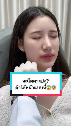 จะฉีดคางกันปะ ถ้าฉีดละได้หน้าแบบนี้😱😨 #fyp #fypシ #รีวิวบิวตี้ในtiktok #รีวิวสกินแคร์ #รีวิวบิวตี้ #รีวิวคลินิก #รีวิว #รีวิวของดีบอกต่อ #fyppppppppppppppppppppppp #fypage #รีวิวฉีดหน้า #รีวิวฟิลเลอร์ #รีวิวฉีดฟิลเลอร์ #ฟิลเลอร์คาง #คางตัด #คางทู่ #คางเรียว #คางสวย #คางเรียววีเชฟ #รีวิวฉีดฟิลเลอร์คาง 