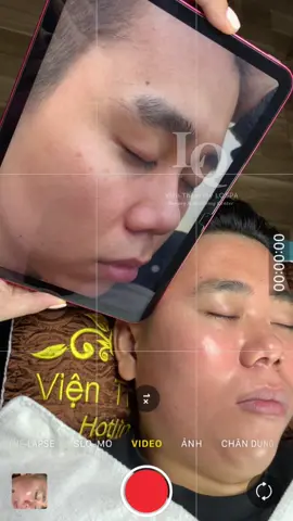 Cập nhật Nám Đinh#chamsocdaseo#chamsocda#chamsocdamun#chamsocdanam#tanbinh      