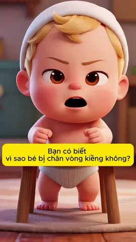 Tập đứng sớm tưởng tốt, ai ngờ dễ khiến bé bị chân vòng kiềng 😱Mẹ đừng nóng vội nha, để con phát triển tự nhiên từng bước✨#ChămSócBé #NuôiConĐúngCách #ChânVòngKiềng #bíkíplàmmẹ 